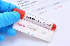 Những lưu ý khi thực hiện test nhanh Covid-19 tại nhà