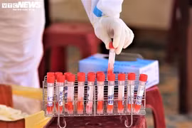 Quảng Nam: Hai bệnh nhân tâm thần mắc COVID-19 chưa rõ nguồn lây nhiễm