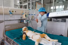 Bộ Giáo dục và Đào tạo yêu cầu báo cáo 3 trẻ mầm non bị bỏng do học kỹ năng sống
