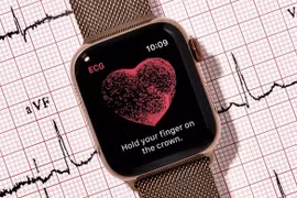 Apple thâu tóm thêm một startup công nghệ chuyên về giám sát sức khỏe