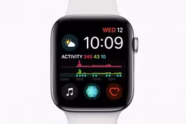 Apple Watch trong tương lai có thể được trang bị camera ở dây đeo