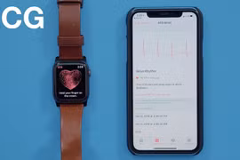 Tính năng đo ECG trên Apple Watch nay đã hỗ trợ trên 20 quốc gia