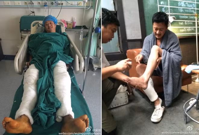 Anh gặp chấn thương hầu như ở các vùng trên cơ thể.
