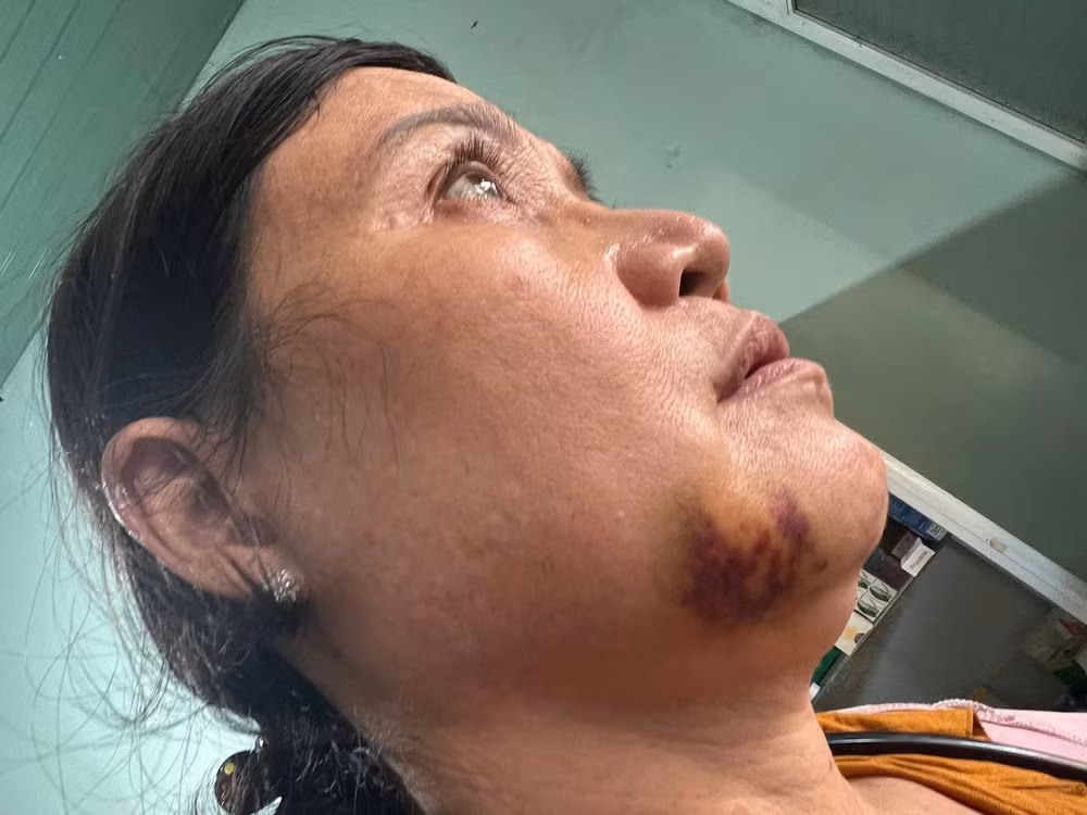 vu nu pho tram y te o gia lai bi nhom nguoi dan ong danh hoi dong nguoi trong cuoc noi gi hinh 2
