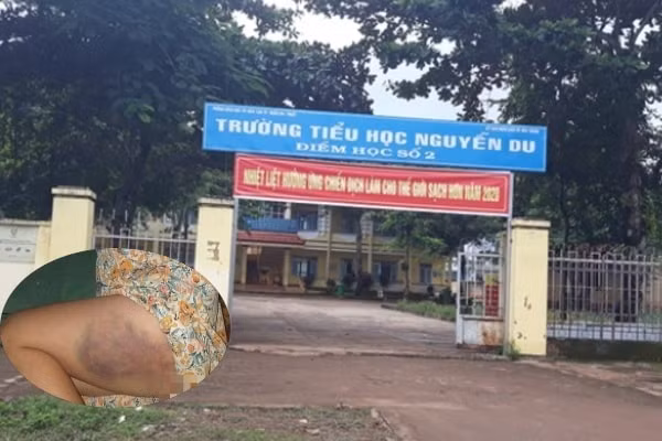 Hình ảnh trường Tiểu học Nguyễn Du nơi xảy ra sự việc cô giáo đánh học sinh bầm tím đùi. Ảnh: vietnamnet.vn
