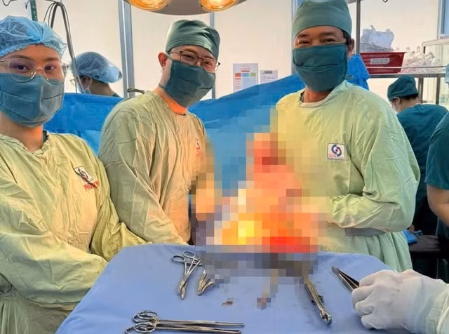 Thai phụ mắc bệnh cực hiếm Budd-Chiari vượt cạn an toàn- Ảnh 2.