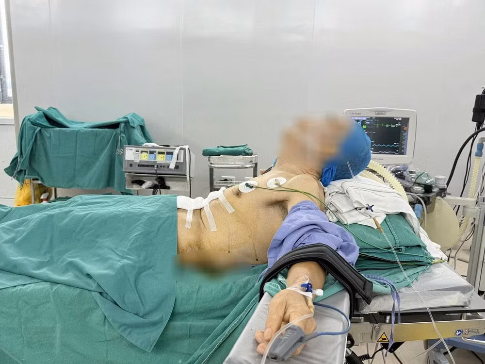 Bệnh nhân 'nửa nằm, nửa ngồi' trong ca phẫu thuật ung thư dạ dày- Ảnh 2.