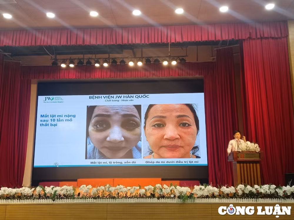 lam gi de tranh su co y khoa hinh 1