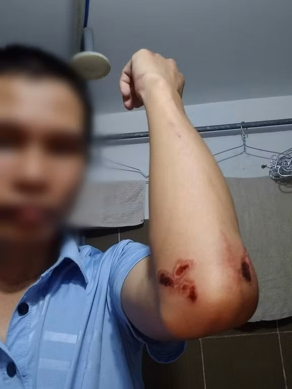 tai xe xe om cong nghe bi hanh hung da man truoc cong ben xe mien tay hinh 2