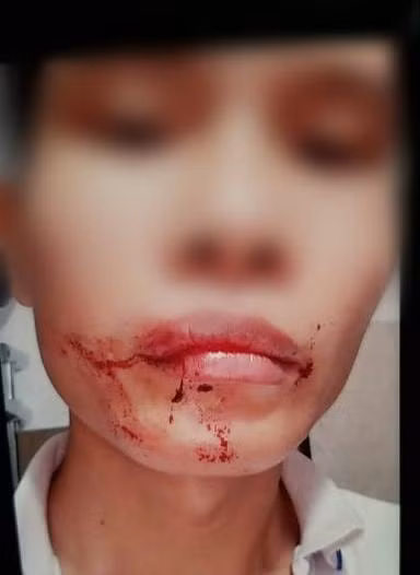tai xe xe om cong nghe bi hanh hung da man truoc cong ben xe mien tay hinh 1