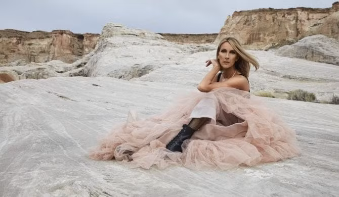 celine dion tiet lo mac hoi chung than kinh hiem gap hinh 1