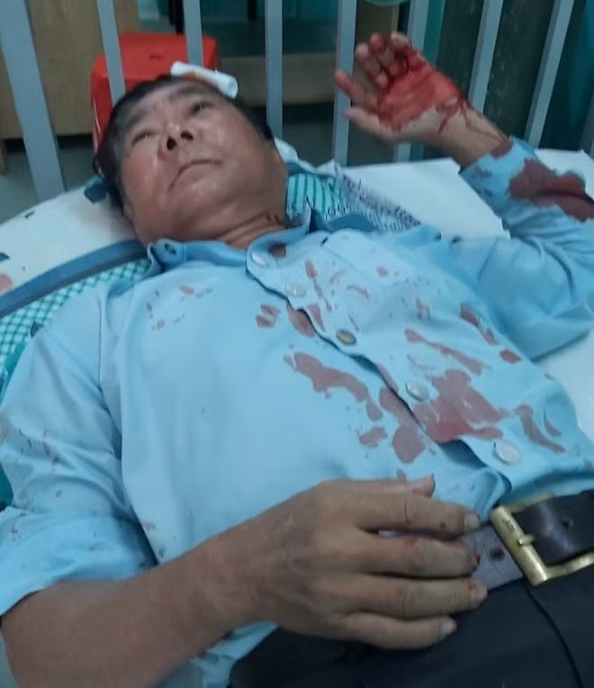 Hình ảnh ông Phúc nằm viện cấp cứu sau khi bị đánh. Ảnh: thanhnien.vn