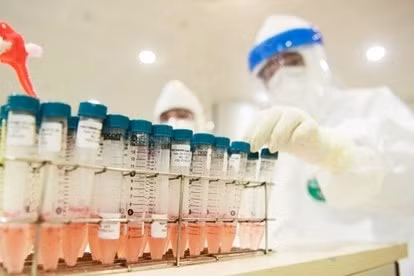 chong tieu cuc trong mua sam sinh pham xet nghiem thuoc va vaccine phong covid 19 hinh 1