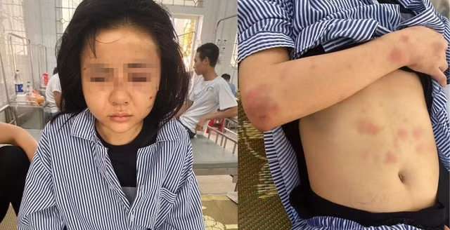 Cô gái bị hành hung suốt 2 giờ ở Yên Bái. Ảnh: TL.