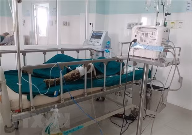 Bà Tô Thị Thanh Xuân được cấp cứu tại Bệnh viện Đa khoa tỉnh Kon Tum song đã tử vong do vết thương quá nặng. (Ảnh: TTXVN)