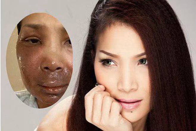hồng ngọc2