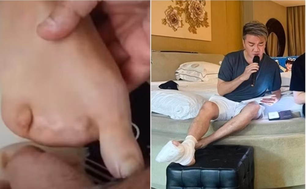 thong tin ca si dam vinh hung bi mat 4 ngon chan la sai su that hinh 1