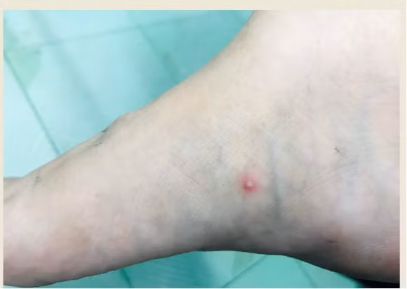 tp hcm benh nhan dau mua khi dau tien dang co tien trien tot hinh 2
