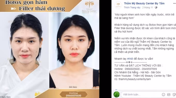 Hình ảnh những ca sĩ nổi tiếng, khách hàng được Thẩm mỹ viện Beauty Center by Tấm quảng cáo vô tư trên website và Facebook