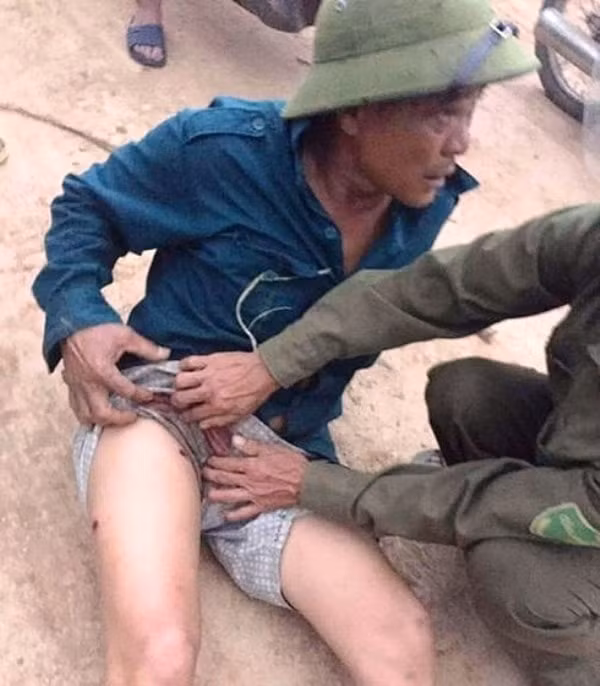 Ông Nguyễn Văn Lý bị nhóm người đi ô tô dùng súng bắn 3 phát đạn vào đùi chân phải. Ảnh cắt clip