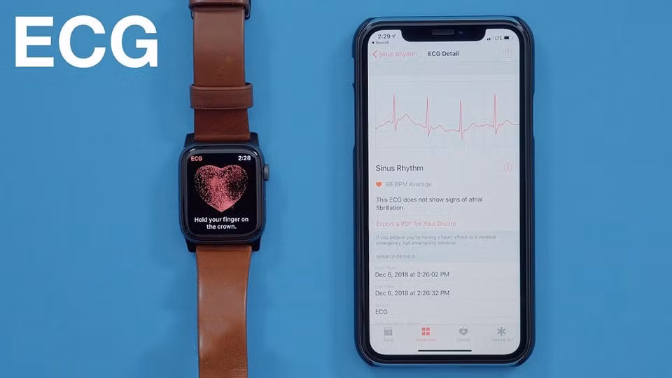 Tính năng đo ECG trên Apple Watch nay đã hỗ trợ trên 20 quốc gia.