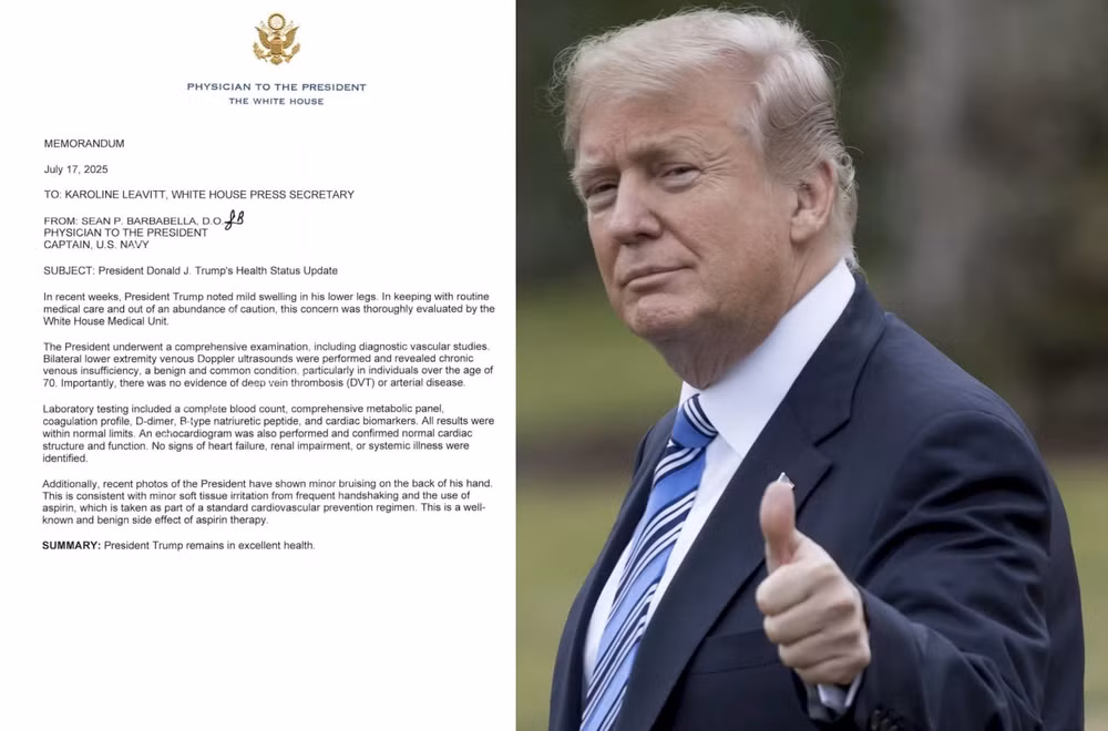 Trump suc khoe
