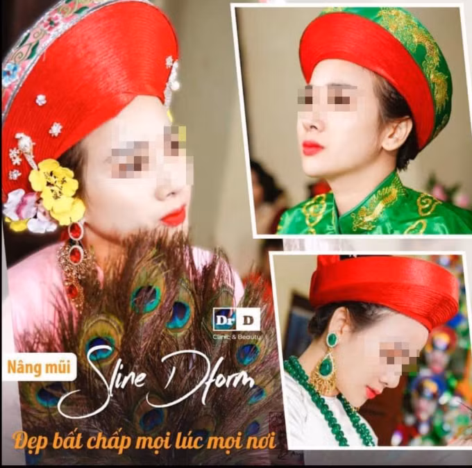 Thẩm mỹ DrD tự ý sử dụng hình ảnh cá nhân để quảng cáo dịch vụ nâng mũi (Ảnh chụp màn hình).
