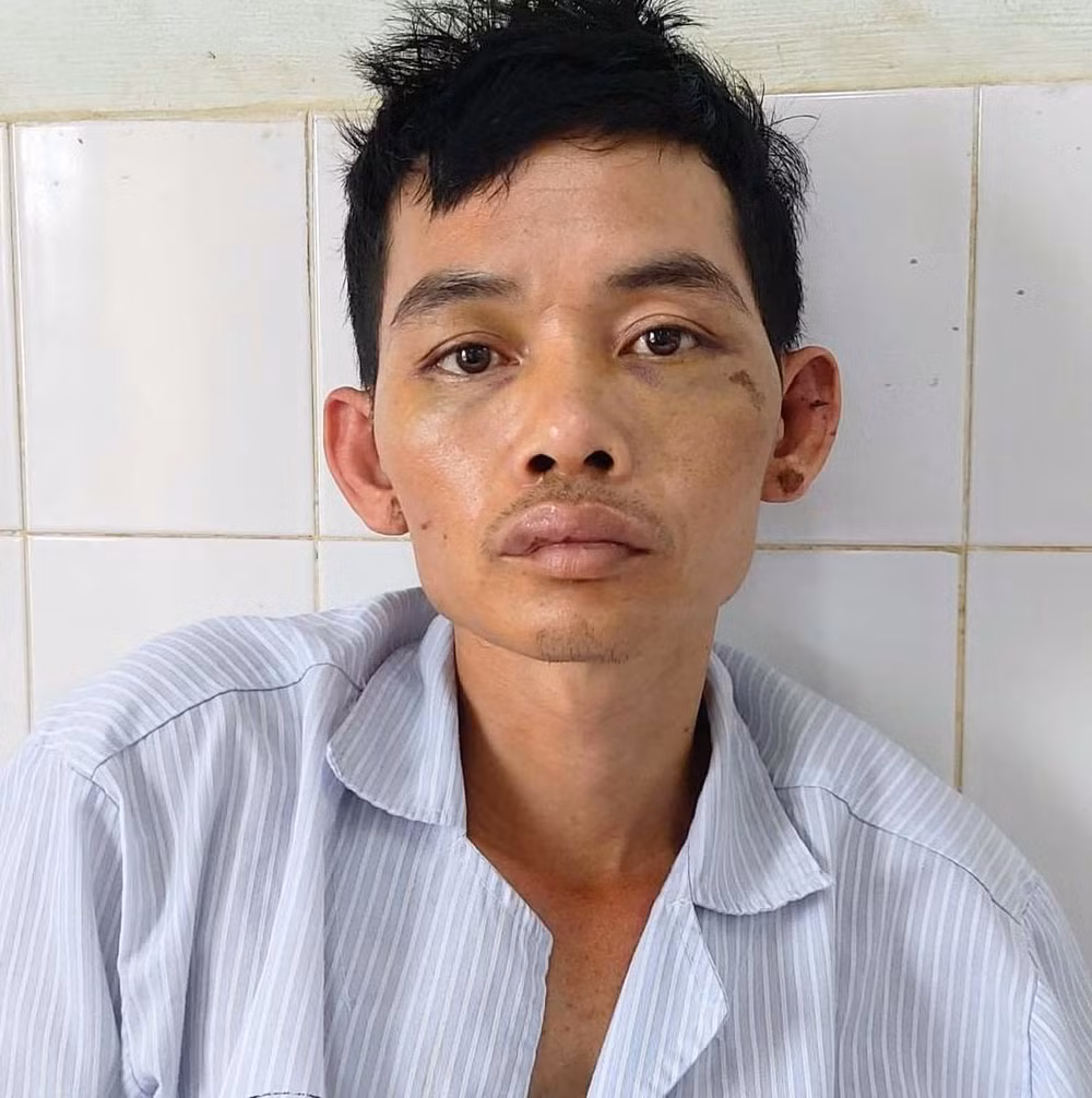 mot thanh nien o gia lai bi danh nhap vien vi trom xe may hinh 1