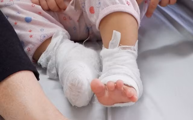 tre bi nhiem trung mau do bi bong khi xong hoi phong covid 19 hinh 1