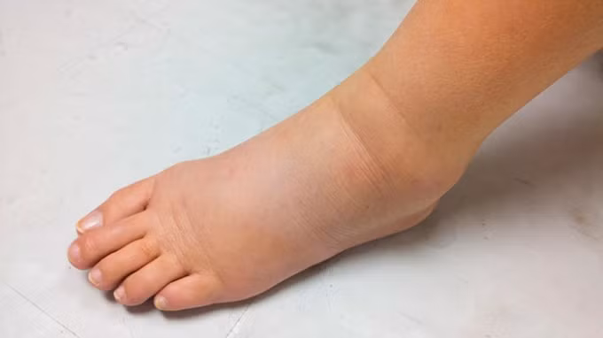 bong mat canh bao nhung dau hieu gi ve suc khoe hinh 3