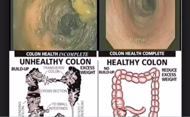 nhung loi ich cua detox rua dai trang bang nuoc hinh 1