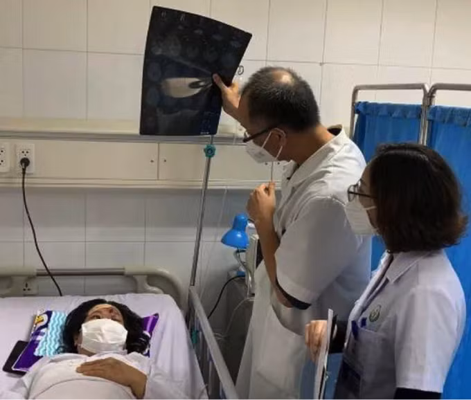 ruoc hoa vao than khi tiem filler tai cac co so tham mi khong giay phep hinh 2