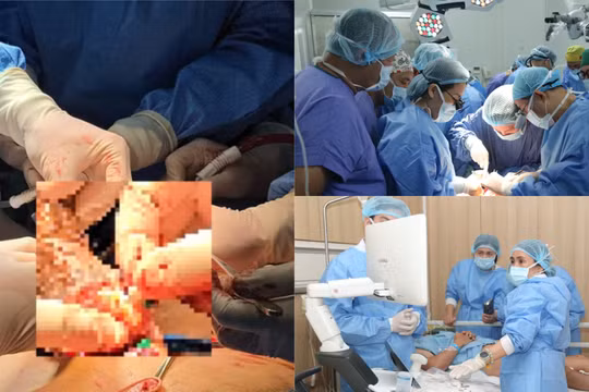 Dấu mốc mới của y học Việt Nam: Ghép thành công bộ phận sinh dục nam từ người chết não