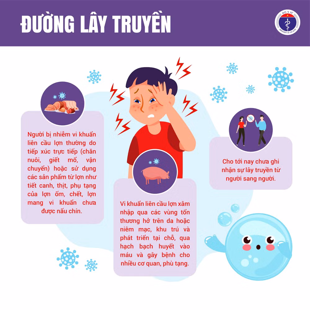 Liên cầu lợn 3