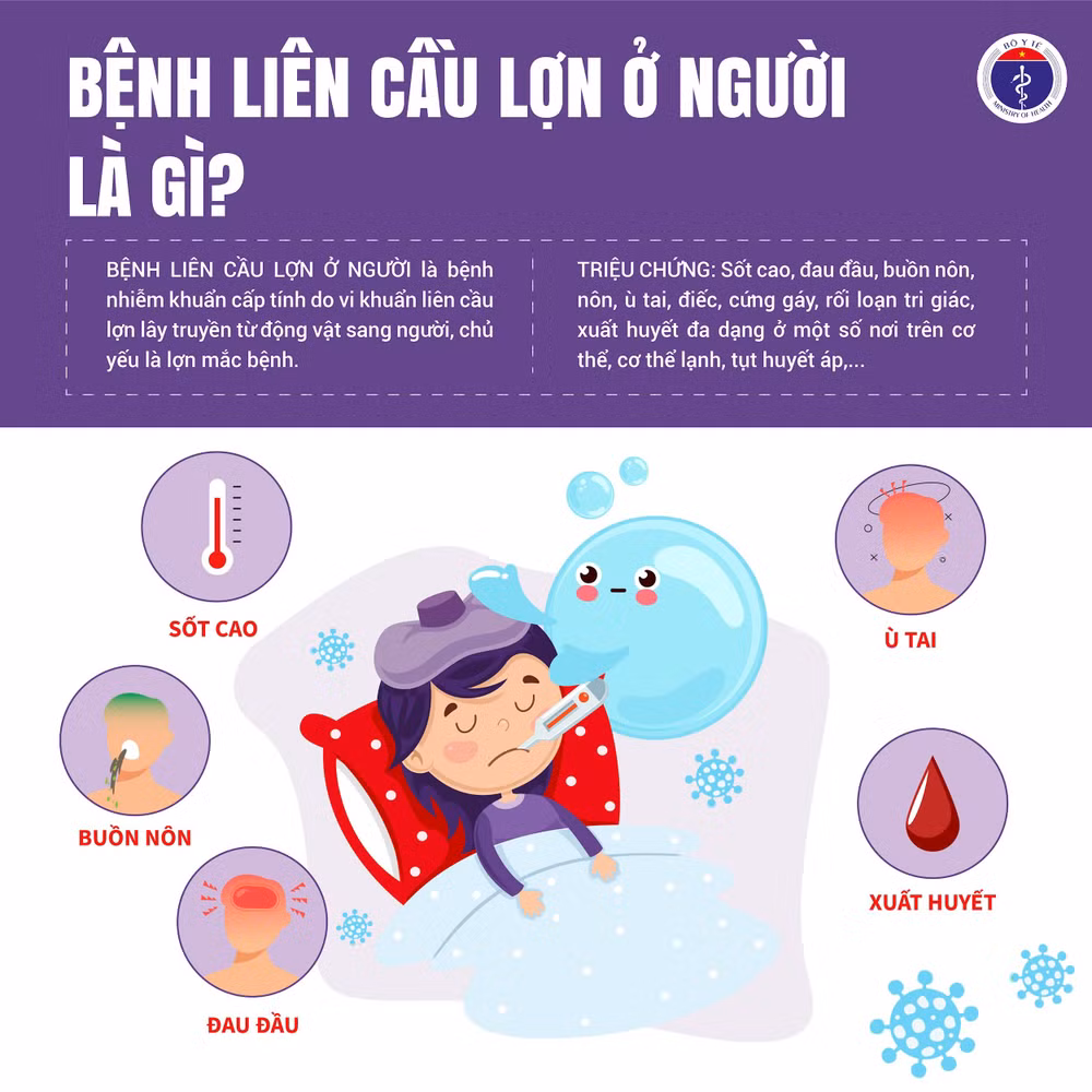 Liên cầu lợn 1