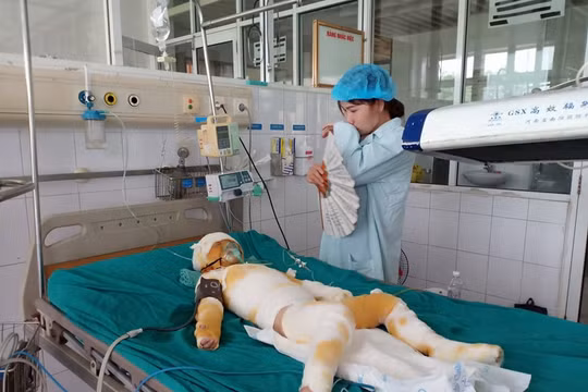 Bộ Giáo dục và Đào tạo yêu cầu báo cáo 3 trẻ mầm non bị bỏng do học kỹ năng sống