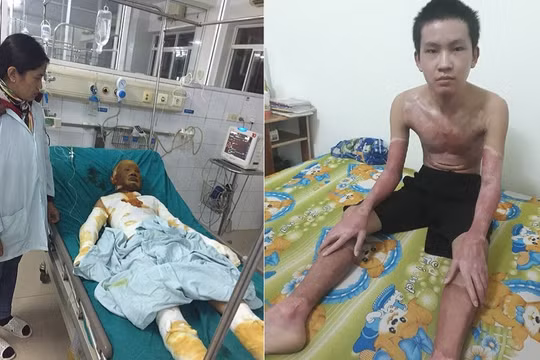 Sự sống hồi sinh với tấm thẻ màu xanh…