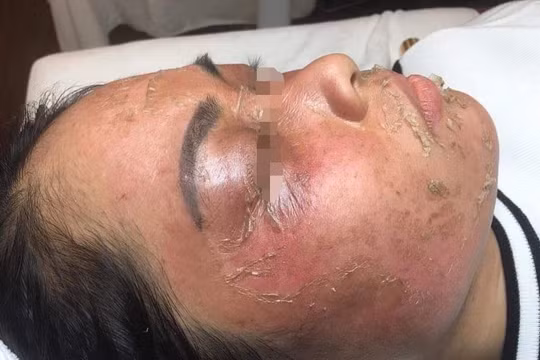 Công ty TNHH Quốc tế Linh Ngân bị "tố" phân phối mỹ phẩm kém chất lượng?