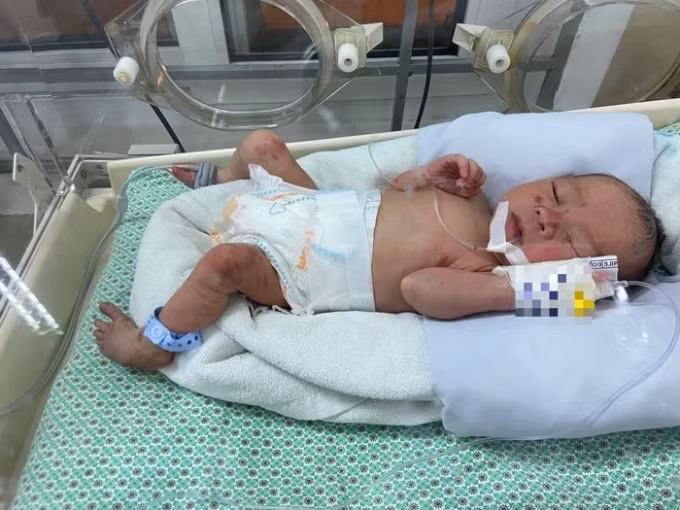 Bé sơ sinh bị bỏ rơi giữa khe tường đã qua cơn nguy kịch. Ảnh: TL.