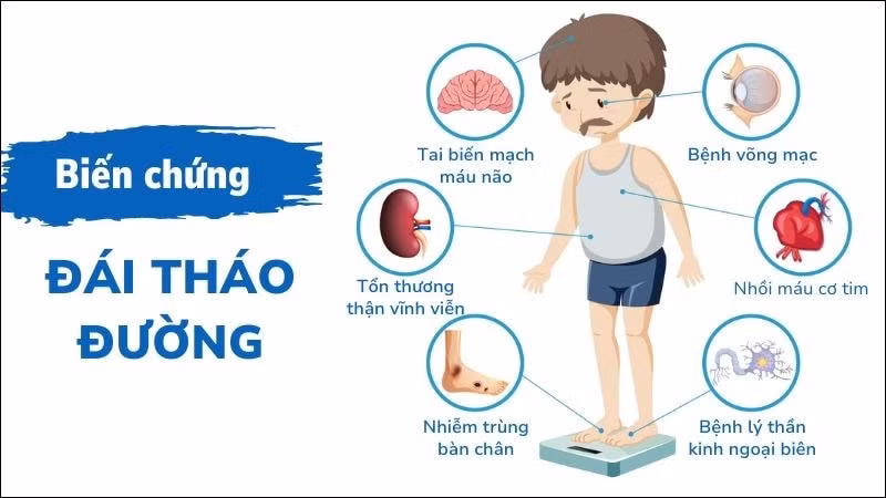 tieu-duong-dai-thao-duong-18-800x450-1.jpg