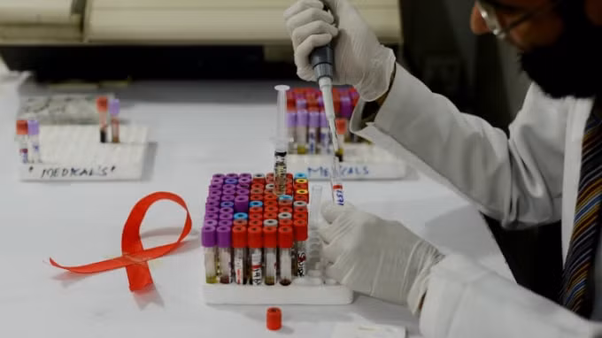 Đã tìm ra phương pháp có thể điều trị dứt điểm HIV. Ảnh minh họa.