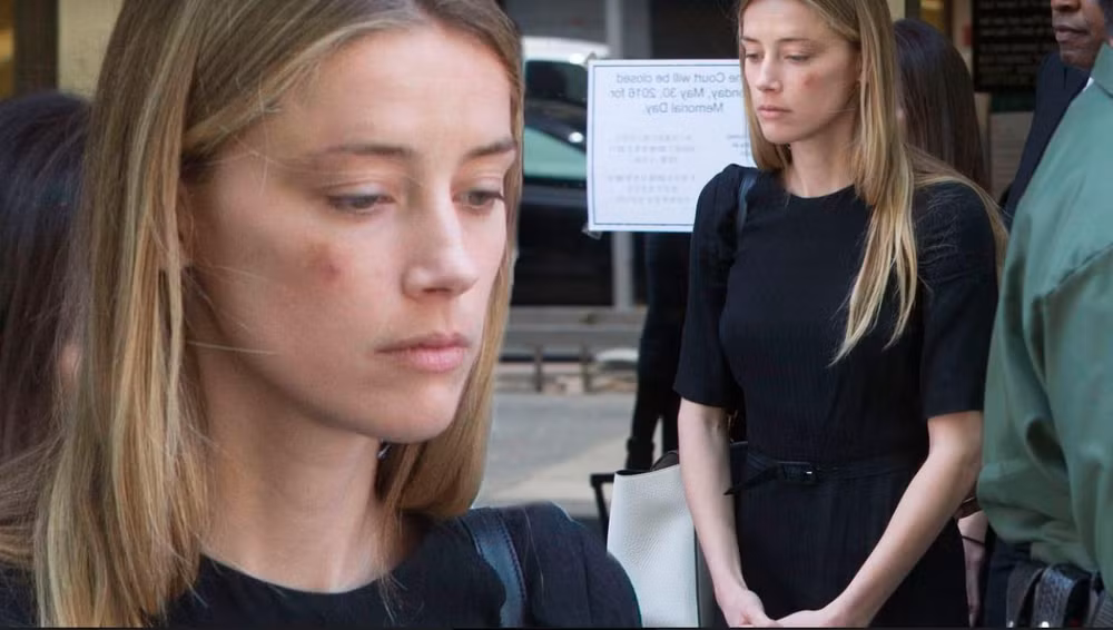 amber heard vo cu cua johnny depp bi chuan doan roi loan nhan cach hinh 7