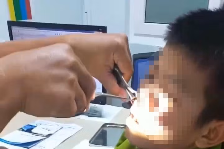 kon tum gap con vat dai 8cm song trong mui thieu nien 15 tuoi hinh 1