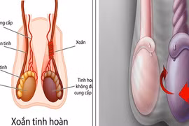 Phú Thọ: Nam thanh niên hỏng "của quý" do đến viện muộn