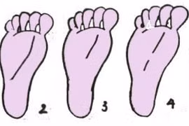 Xem tướng bàn chân: Đường Định mệnh bàn chân nói lên điều gì?