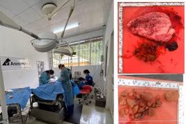 Lào Cai: Gấu đang cứu hộ ở Vườn quốc gia Hoàng Liên được đại phẫu sỏi mật an toàn