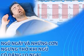 Ngáy ngủ là bệnh lý, nhiều nguy cơ có hại cho sức khỏe
