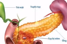Bệnh lý tuyến tụy liên quan đến rượu và ăn uống