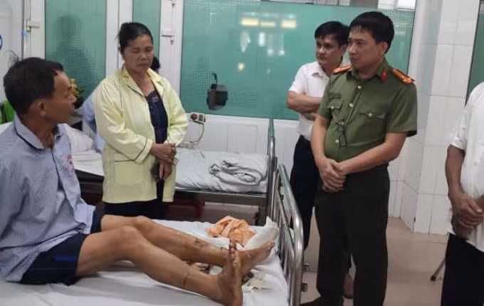 Ông Phạm Trung Kiền (công an viên) bị chém đứt gân chân, mẻ xương chân. Ảnh: CA.