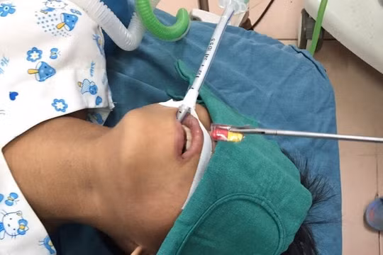 Uống thuốc còn cả vỏ, bé trai 10 tuổi ở Đồng Nai phải nhập viện cấp cứu